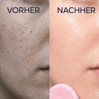 Hautdetail vor und nach der Anwendung des Kōji Glovi