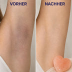 Haut vor und nach der Anwendung des Kōji Salt Bar
